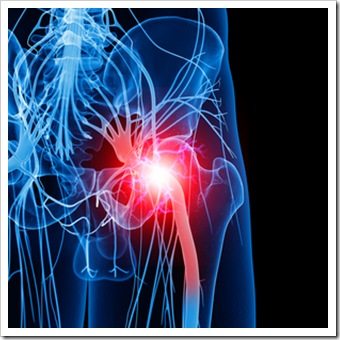 Leg Pain Broomall PA Sciatica